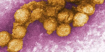 Neue Seuche mit hohen Todesfallzahlen breitet sich aus