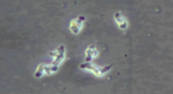 Tödliche Amöbe nistet sich in menschlichen Gehirnen ein