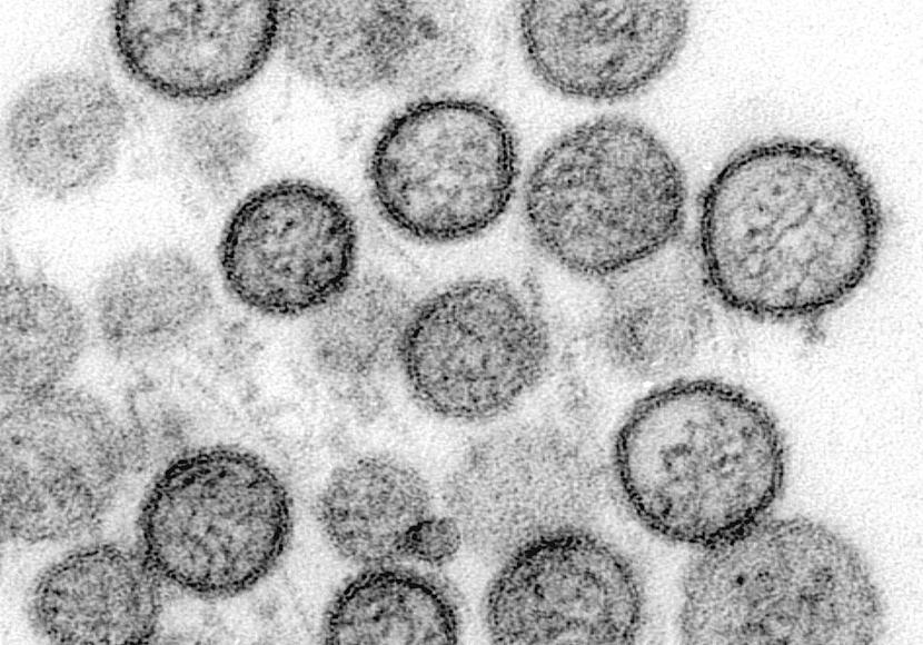 WHO: Hantavirus auf Schiff wurde von Mensch zu Mensch übertragen